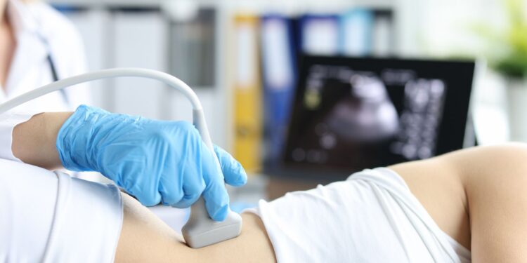 functions of the spleen include all of those below except