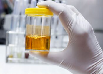 white stuff floating in my urine could i be pregnant