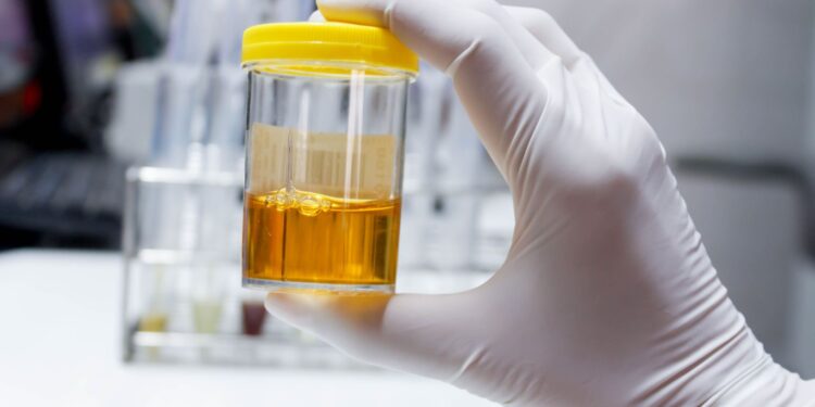white stuff floating in my urine could i be pregnant