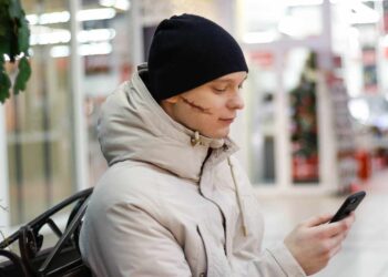 how did miles teller get the scars on his face