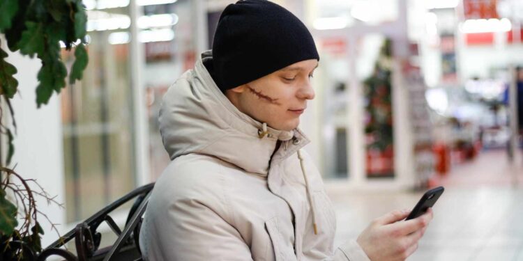 how did miles teller get the scars on his face